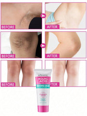 Underarm Whitening Cream To Remove Underarm Darkness