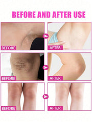 Underarm Whitening Cream To Remove Underarm Darkness